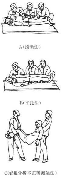 第三节骨折固定技术