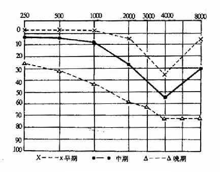 噪声性聋气导听力曲线