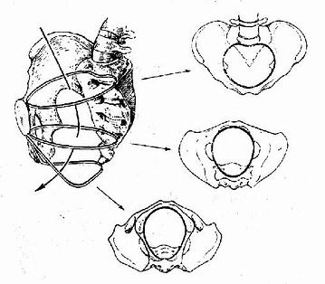 骨产道三个平面解剖图图片