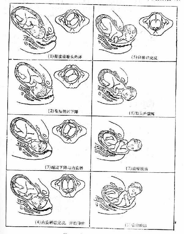 胎儿娩出的七个步骤图图片