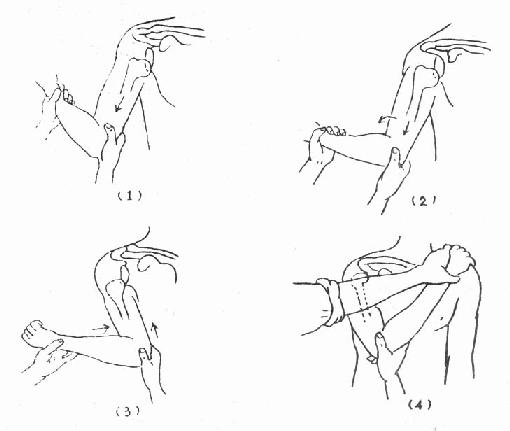 肩关节脱位手牵足蹬法图片