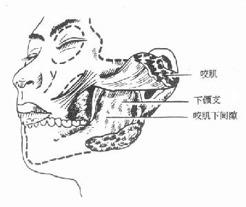 咬肌间隙图片