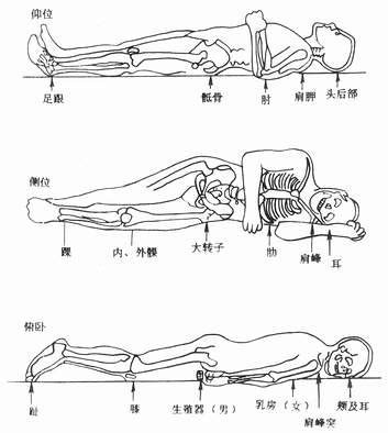 俯卧位受压部位图片图片