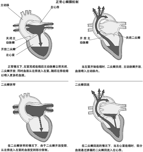 心脏瓣膜及血流示意图图片