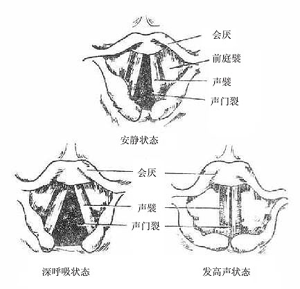 声门裂图片图片