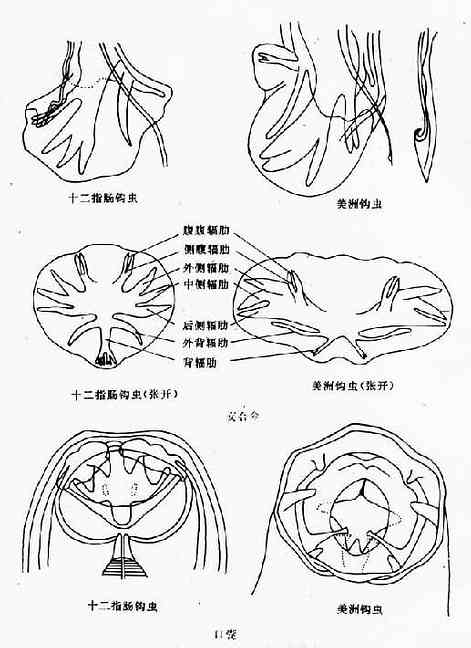 十二指肠钩虫手绘图片