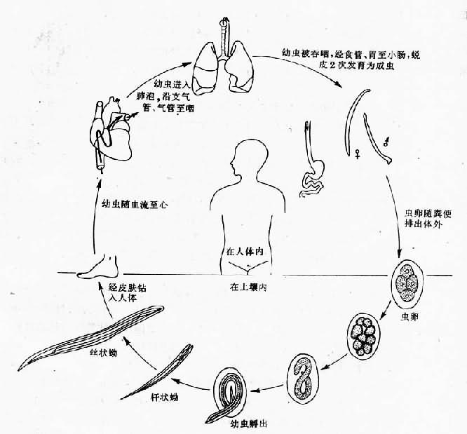 钩虫图片手绘图图片