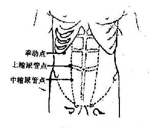 肾,输尿管疾病压痛点示意图