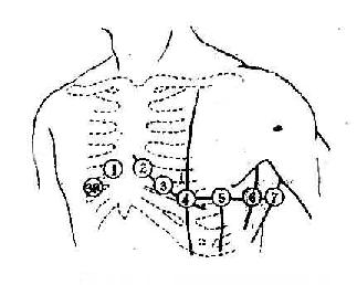 女性心电图位置示意图图片