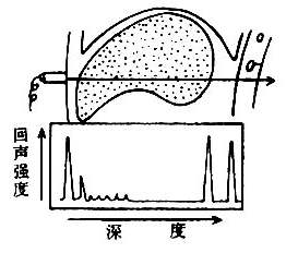 四,超声诊断仪简介_《物理诊断学》_抓药网