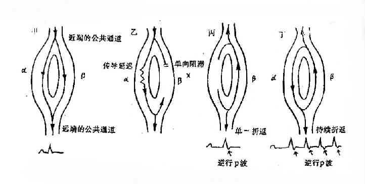 折返机制图片