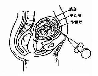 羊的注射部位示意图图片